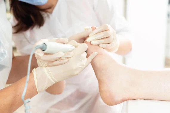 Tratamiento para el pie diabético en nuestra clínica de Doña Mencía Tratamiento para el pie diabético en nuestra clínica de Doña Mencía